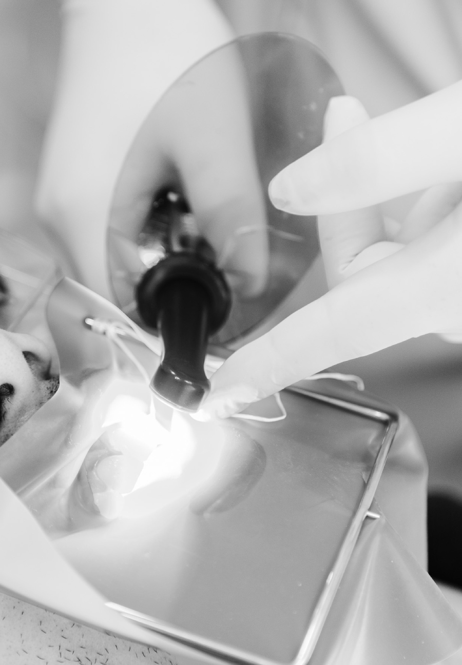 Resultado de Lentes de Contato Dental Facetas em Porcelana na Vila Clementino. Paciente da RM Odontologia Integrativa. incisivo central e lateral