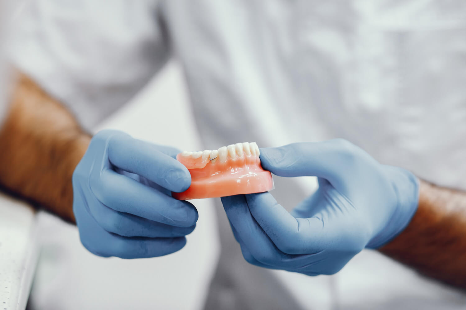 Mãos com luvas azuis segurando um modelo de prótese dentária para planeamento de reabilitação oral. Especialista na Vila Clementino na clínica RM Odontologia.
